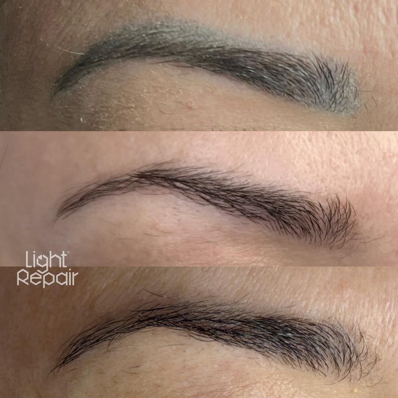 Resultado antes e depois, Light Repair