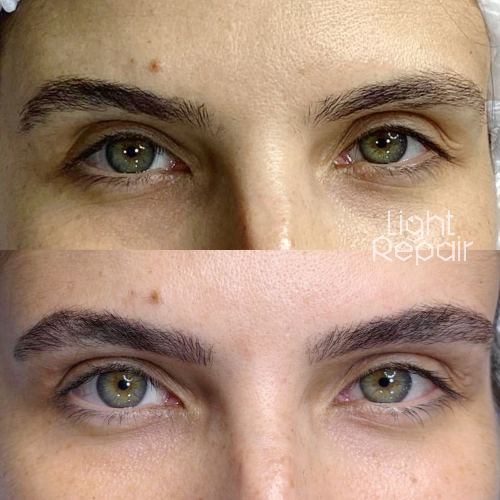 Resultado antes e depois, Light Repair