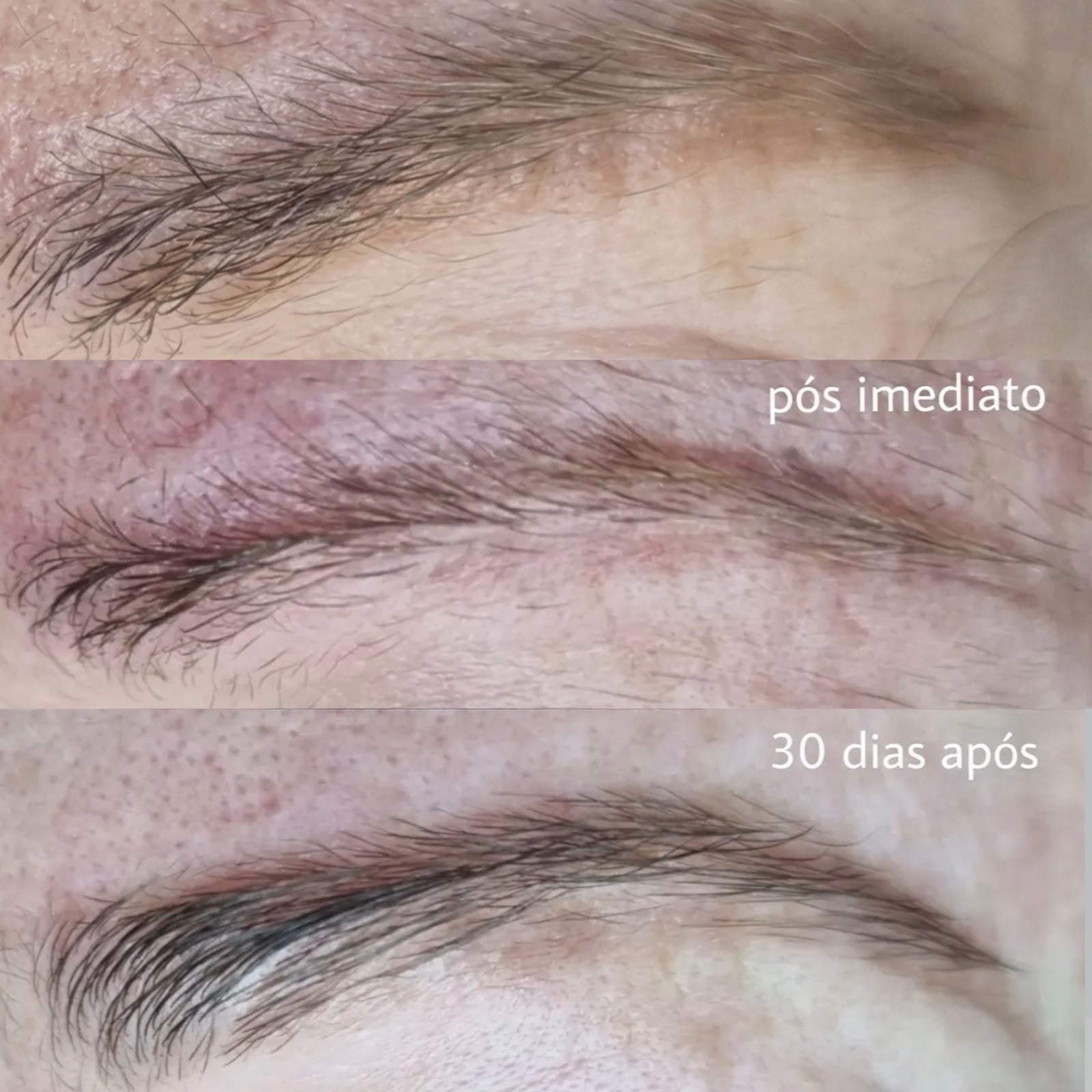 Resultado antes e depois, Light Repair
