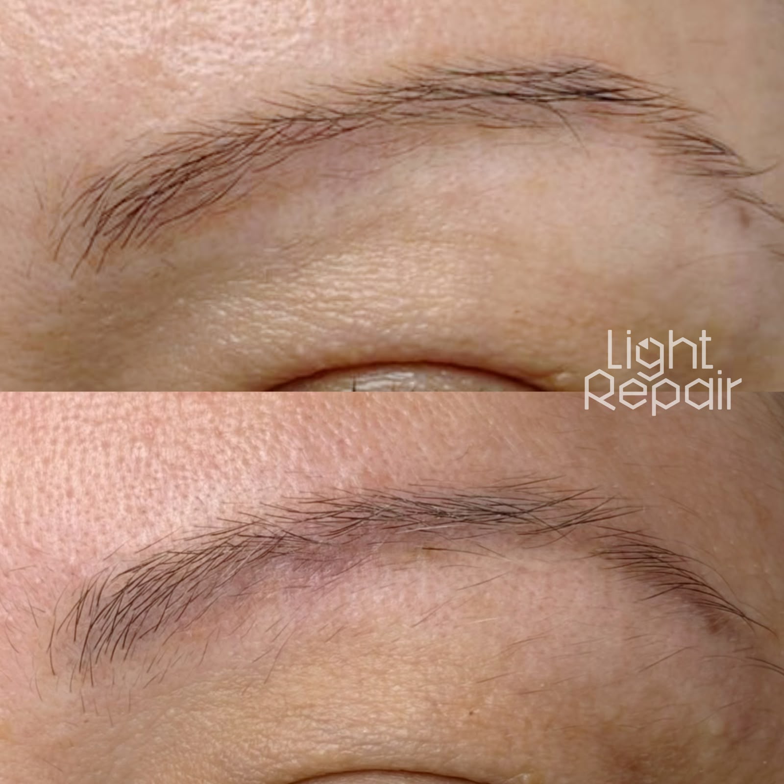 Resultado antes e depois, Light Repair